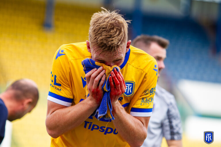 Teplice jsou příliš hodné. Musí se naučit rozdávat rány